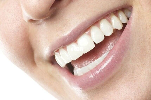 牙齿烟渍茶渍怎么去除最有效小妙招(牙齿烟渍茶渍怎么去除最有