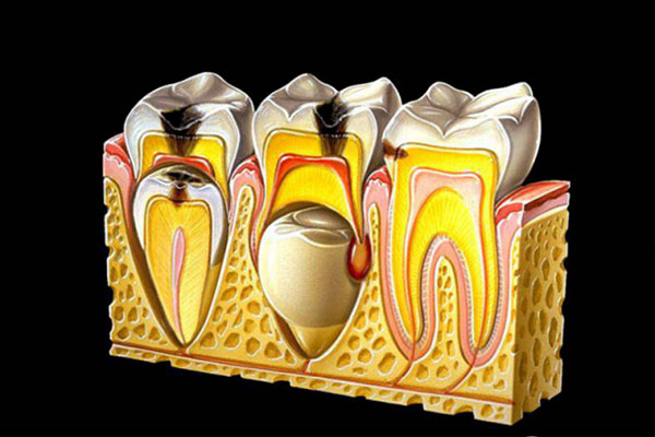 四环素牙主要沉积在什么地方(四环素