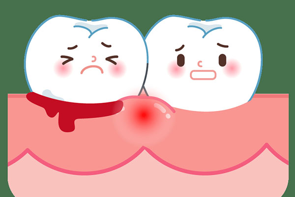 刷牙时牙龈老是出血是什么原因而且还有味道