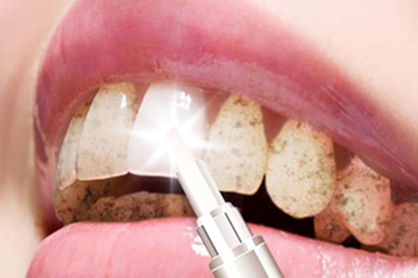 墙面泛黄刷什么可以阻挡