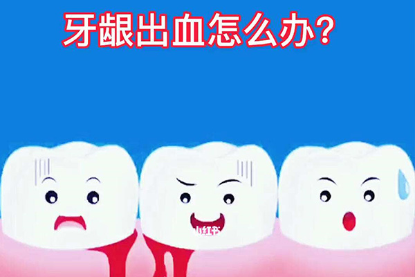 刷牙容易出血是什么问题引起的