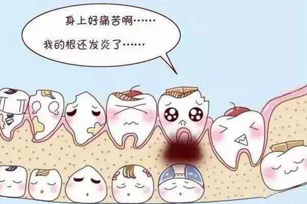 孩子牙齿根尖炎很痛怎么办呀(孩子牙