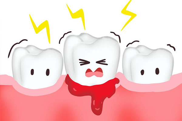 刷牙牙龈出血是缺钙吗