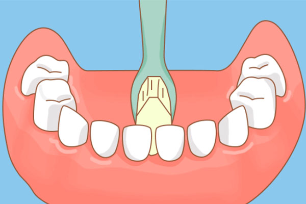 中老年口腔医生亲测：洗牙真的不疼，3步缓解不适！