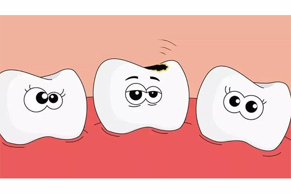 中老年口腔：如何让蛀牙轻松脱落不疼？实用方法分享！