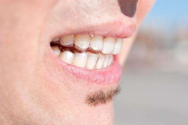 七岁小孩矫正牙齿？中老年口腔专家