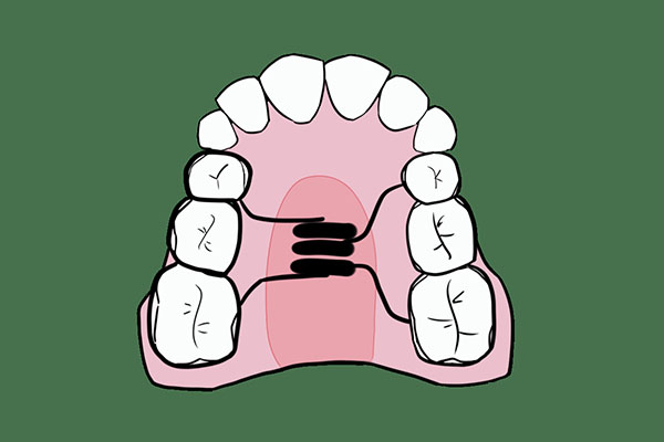 医院镶牙可以用医保卡吗？中老年口腔为您解答