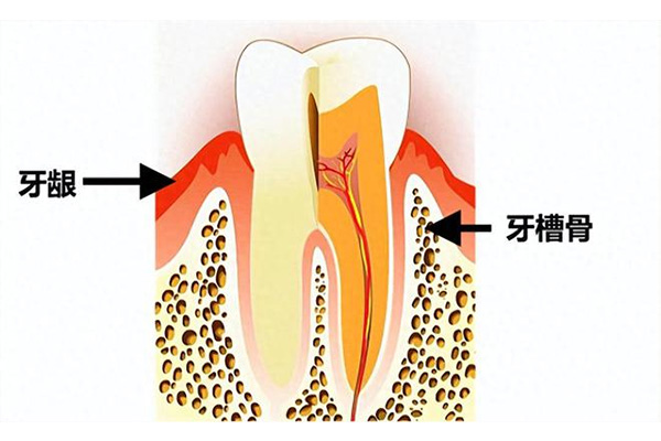微创拔牙 vs 普通拔牙：智齿拔除的舒