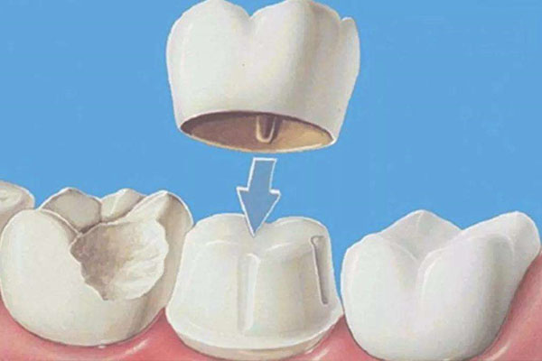 北京中老年口腔修复哪家更高效？批