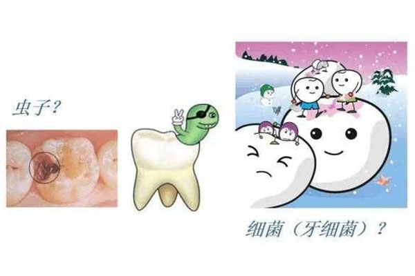 严重蛀牙只剩一半？中老年口腔快速