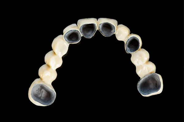 中老年缺牙患者的福音：卡瑞斯玛树