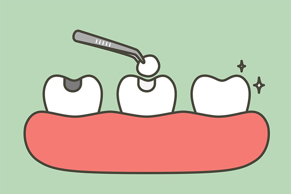 7岁儿童蛀牙需要补牙吗？专家建议这