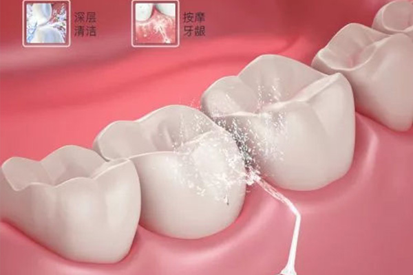 洗牙真能变白？中老年口腔教你高效护牙秘诀！