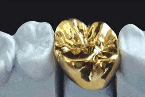 镶牙哪种材料最好 金属烤瓷选哪个更