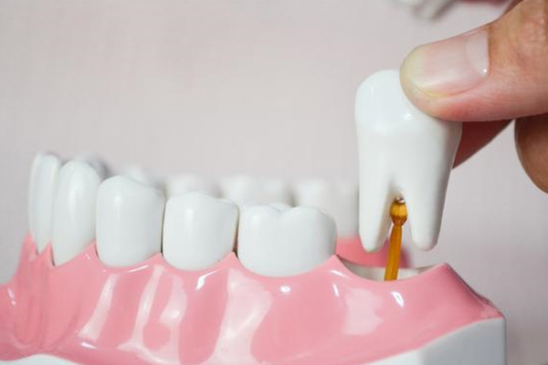 西安拔牙费用权威解答！中老年口腔批量处理缺牙难题，一次高