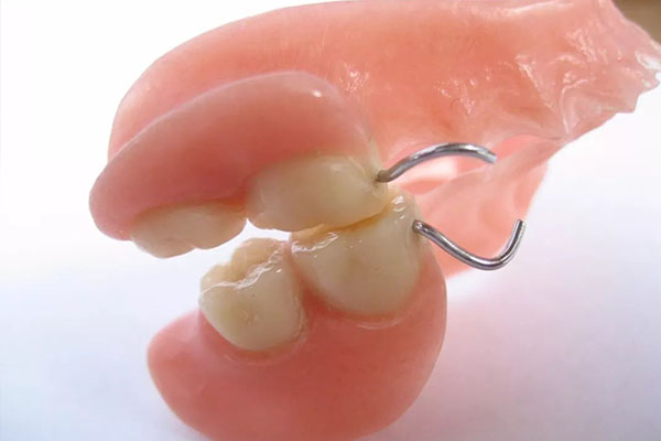 活动义齿优缺点解析，中老年口腔如何选对高效修复方案