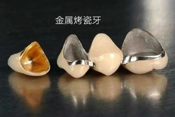 最便宜的全瓷牙能用多久？中老年口