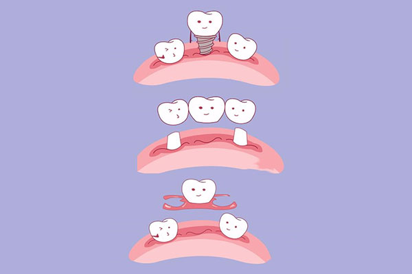 种牙到底好还是不好 一文说透中老年