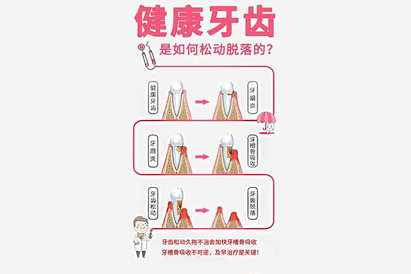 四十岁牙齿脱落是什么原因呢怎么治疗