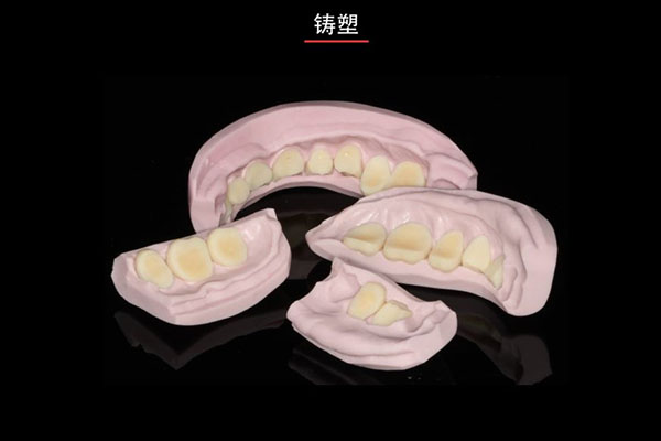 活动假牙要拔牙吗？中老年口腔为您