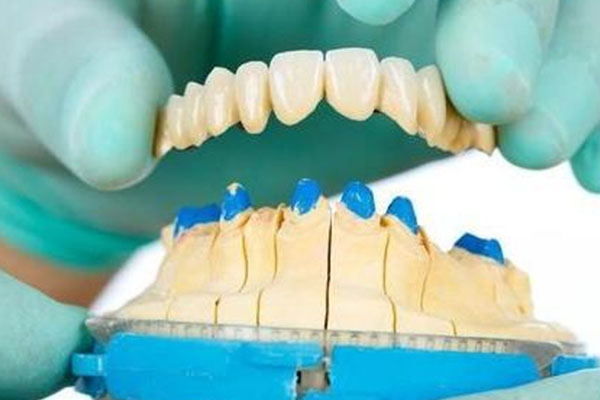 中老年口腔高效方案：全瓷牙套批量定制多久能戴？缺牙老人必