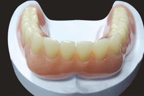 上海义齿公司哪家强？中老年口腔批量修复高效省心价，一站式