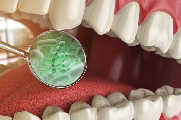 牙髓炎治疗一颗多少钱可以报销吗