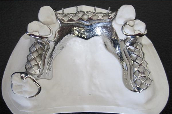 活动假牙有什么好处？中老年口腔为您揭秘轻松解决牙齿缺失烦