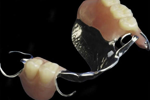 义齿牙多少钱一颗？中老年口腔批量