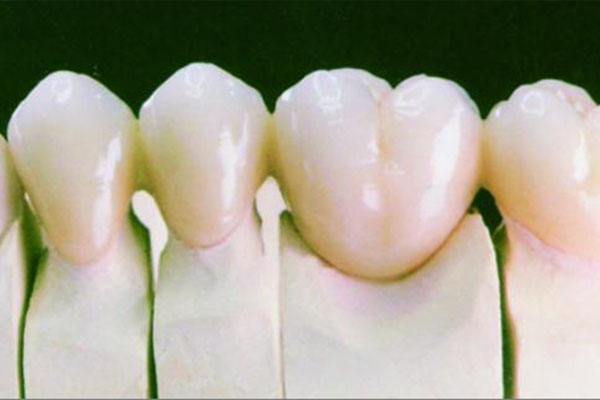 牙冠能用多少年？中老年口腔为您解