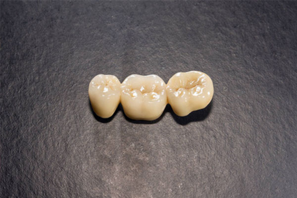 复合树脂补牙新选择：中老年口腔×