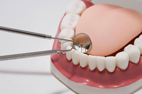 牙齿脱落了一小块需要补吗多少钱一