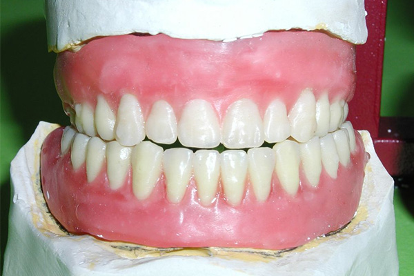 中老年口腔：装一颗普通活动假牙价格揭秘，省钱又省心的修复