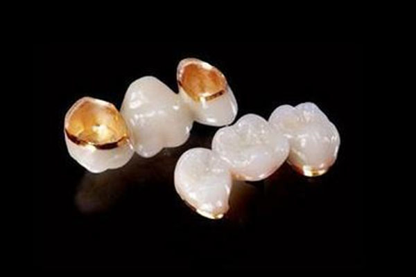 全瓷牙冠材质大揭秘：选对材质不踩坑，中老年口腔一站式解决