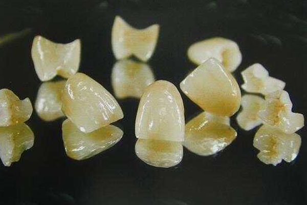 中老年口腔专家教你：牙冠掉落如何