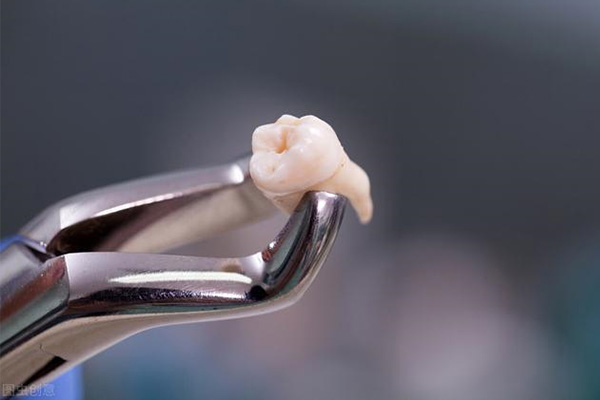 牙医的智齿都拔了吗？中老年口腔批量种牙，省心又高效