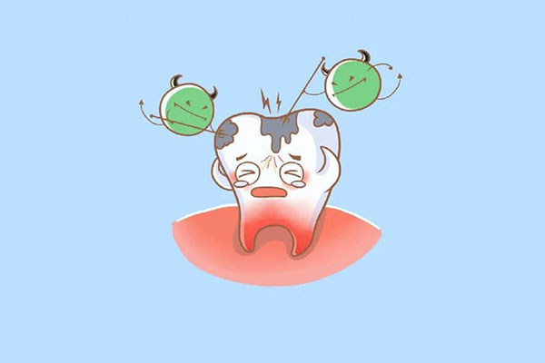 虫牙和蛀牙在医学上称什么？别担心，中老年口腔为您快速解决