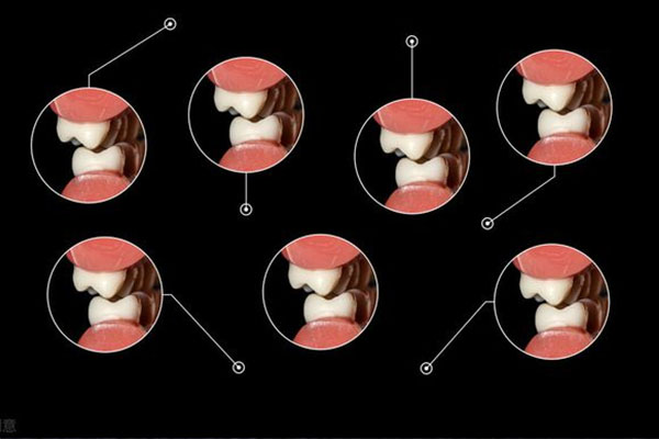中年牙齿松动原因及解决方案，中老