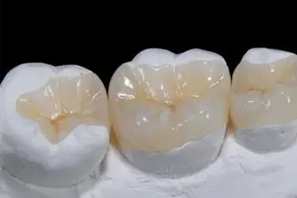 南光树脂胶水厂在哪里？中老年口腔