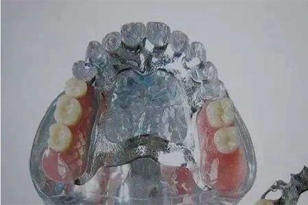 长春义齿加工厂哪家强？中老年口腔为您揭秘行业TOP榜！