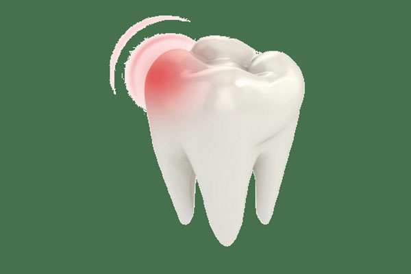 牙齿对咬酸疼难忍？中老年口腔批量修复技术高效解决缺牙难题
