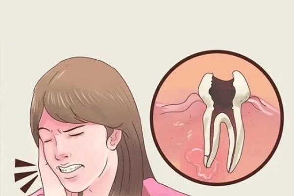 中老年长蛀牙修复价格大揭秘，这样