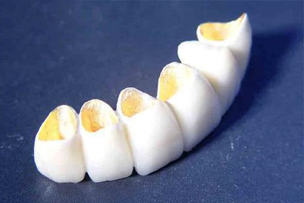 牙冠厂家制作成本多少钱？中老年口