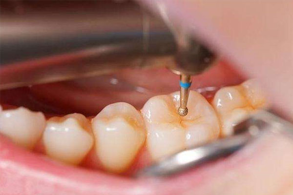 修补牙神经疼吗？中老年口腔高效无痛修复方案，缺牙老人也能