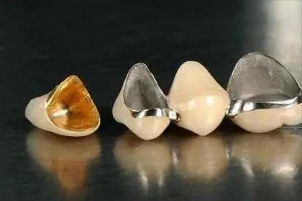 烤瓷牙含金属成分，做核磁共振会有影响吗？中老年口腔为您解