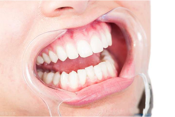 牙髓炎可以不治疗吗？中老年口腔教