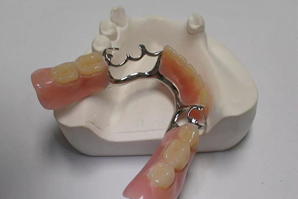 中老年口腔：活动假牙太紧怎么办？