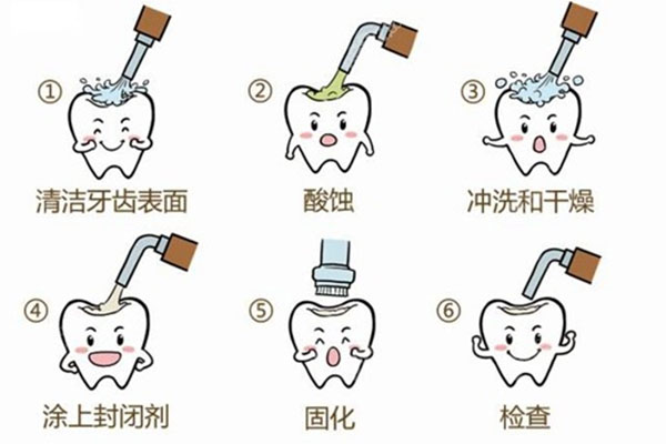 新手爸妈必看：孩子牙齿涂氟注意事项全解析