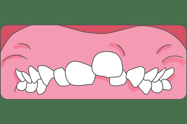 大牙松动别慌张，中老年口腔教你高效解决方法