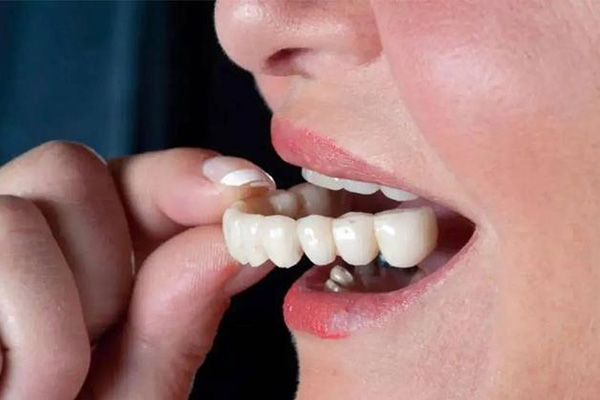 别让缺牙影响生活！中老年口腔专家教你1分钟掌握单独一颗活动